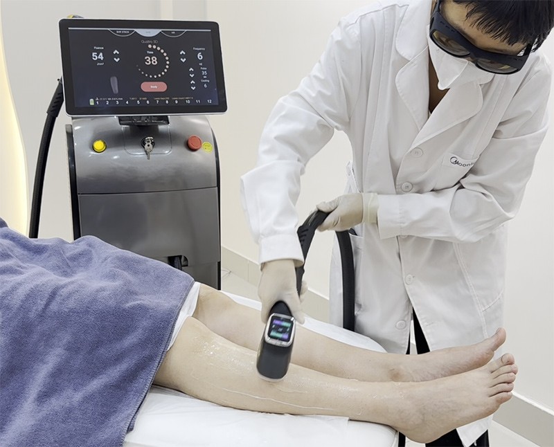 Laser Hair Removal Soprano Ice Machine suppliers